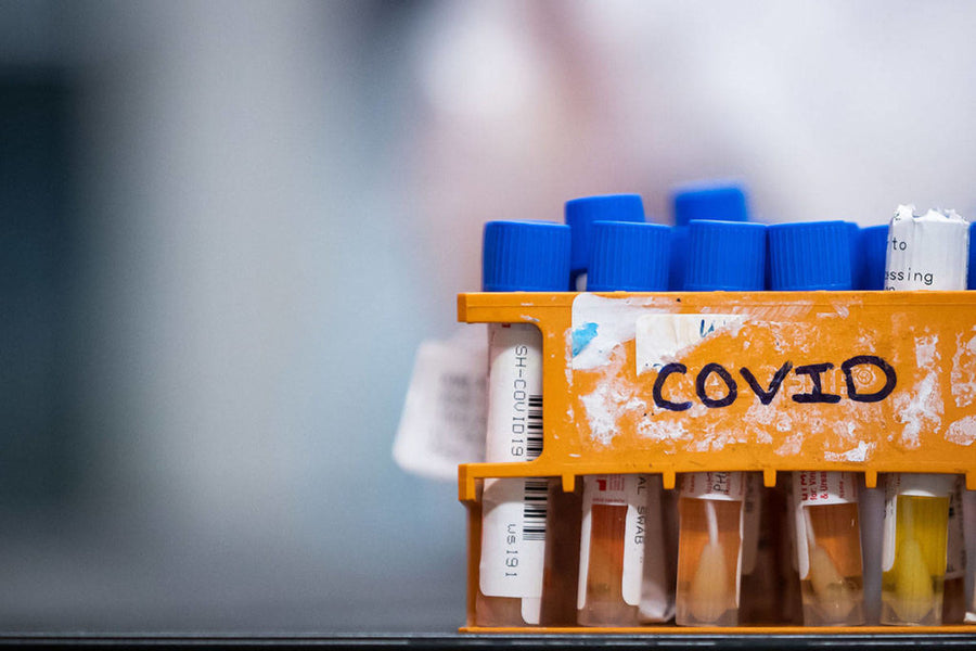 False-positive COVID-19 test results rare despite recent scares, experts say